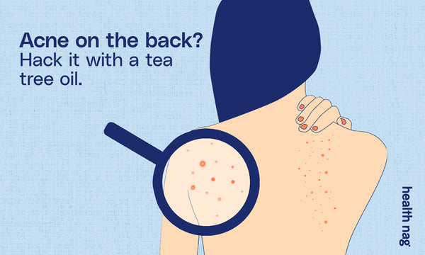 Back acne. Hack it with a tea tree oil.